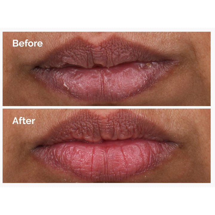 https://www.arcstore.co.za/Files/Images/Ecom/Brands/STU/The%20Ordinary/200464_15ML_E.jpg