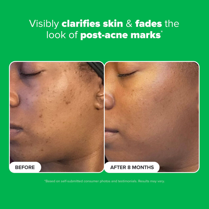 https://www.arcstore.co.za/Files/Images/Ecom/Brands/PQR/Paulas Choice/118814_30ML_E.jpg